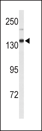 1 - XDH Antibody (N-term) AP9277A