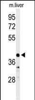 1 - CA5B Antibody (C-term) AP7308b