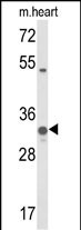 1 - COQ5 Antibody (Center) AP9319c