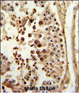 14 - PPP3R2 Antibody (N-term) AP9384a