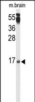 1 - PPP3R2 Antibody (N-term) AP9384a