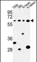 1 - PLCZ1 Antibody (N-term) AP9423a