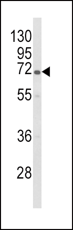1 - GBE1 Antibody (Center) AP9506c