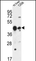 1 - PLA1A Antibody (Center) AP9548c