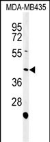 1 - NOXA1 Antibody (C-term) AP9567b