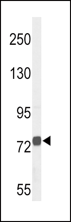 1 - CHAT Antibody (N-term) AP9593a