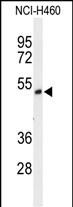 1 - FXRD1 Antibody (C-term) AP9655b