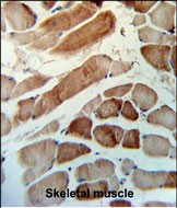 14 - MMAA Antibody (N-term) AP9795a