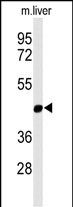 1 - MMAA Antibody (N-term) AP9795a
