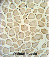14 - PGP Antibody (N-term) AP9853a