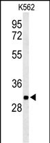 1 - PGP Antibody (N-term) AP9853a