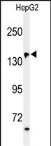 1 - PUR4 Antibody  (N-term) AP4751a