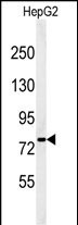 1 - YMEL1 Antibody (N-term) AP4882a