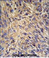 14 - HSP90B1 Antibody (N-term) AP4899A