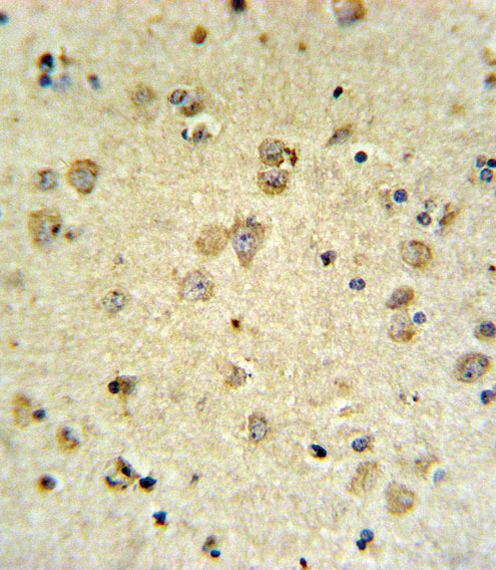 14 - MAP4K3 Antibody AP9860A