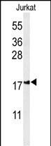 1 - IMP2L Antibody (Center) AP9993a