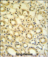 14 - H6PD Antibody (C-term) AP5039b