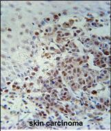 14 - XRCC1 Antibody (Center) AP5545C