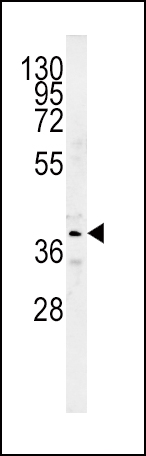 1 - SRD5A2 Antibody (Center) AP5552c