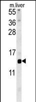 1 - GAL Antibody (C-term) AP5746b