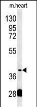 1 - PON2 Antibody (Center) AP5760c