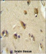 14 - APOL6 Antibody (Center) AP10113c