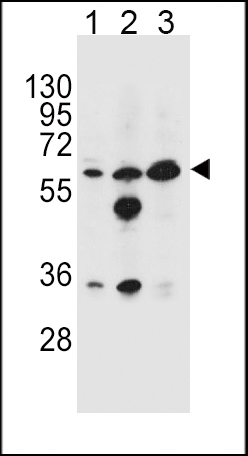 1 - GATM Antibody (N-term) AP10442a