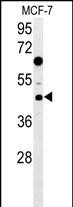 1 - DNAJA1 Antibody (Center) AP5849c