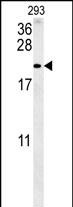 1 - TAC1 Antibody (C-term) AP5872b