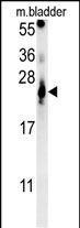 1 - ATP5G2 Antibody (C-term) AP5906b