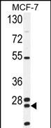 1 - NUDT8 Antibody (N-term) AP10560a