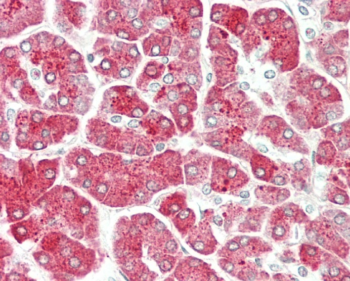 14 - PRSS1 Antibody (Center) AP10735c