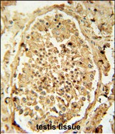 14 - PDHA2 Antibody (Center) AP10756c