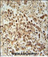 14 - VCX1 Antibody  (N-term) AP10827a