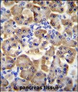 14 - SLC35F3 Antibody (Center) AP11376c