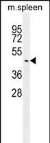 1 - SLC35F3 Antibody (Center) AP11376c