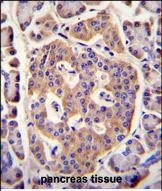 14 - PLD5 Antibody (C-term) AP11598b