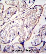 14 - PYCR2 Antibody (Center) AP11852c