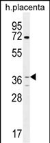 1 - OR2AT4 Antibody (C-term) AP11920b