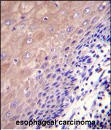 14 - GCLC Antibody (N-term) AP11943a