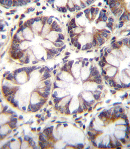 14 - SLC36A1 Antibody (N-term) AP12170A