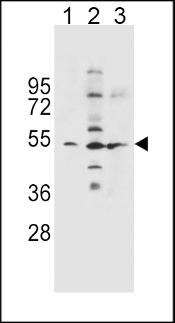 1 - SLC36A1 Antibody (N-term) AP12170A
