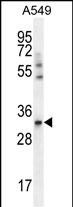 1 - SLC25A6 Antibody (Center) AP12188C
