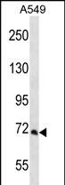 1 - PCCA Antibody (Center) AP12328c