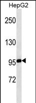 1 - MASTL Antibody (ascites) AM1911a