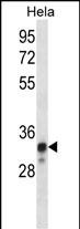 1 - NDUFS8 Antibody (Center) AP12552c