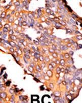 14 - RFK Antibody (N-term) AP7183a