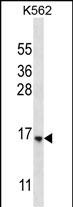 1 - STARD5 Antibody (N-term) AP12823a