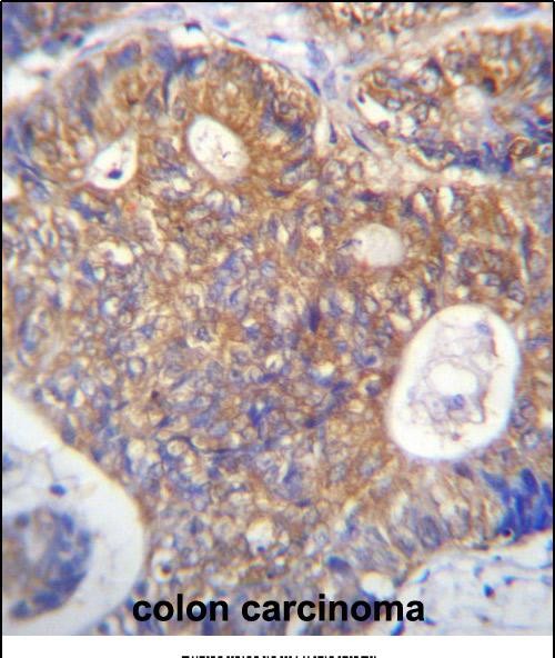 14 - PAICS Antibody (N-term) AP12945a