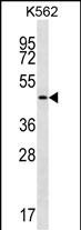 1 - GIF Antibody (Center) AP12975C